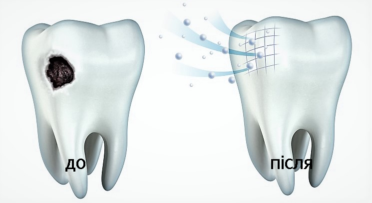 restavracziya zubiv